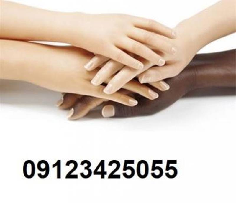 طراحی و ساخت انواع دست مصنوعی در تهران