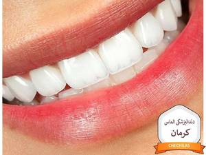 دندانپزشکی الماس کرمان