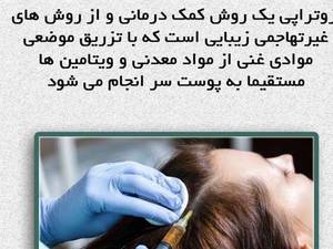 مزوتراپی سر