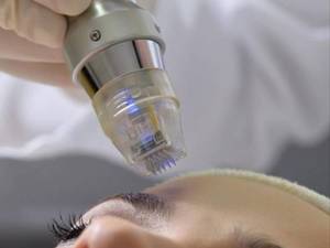 خدمات آر اف Rf فرکشنال