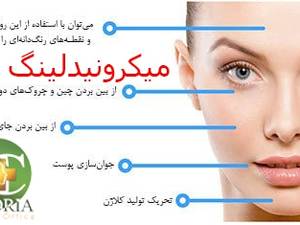 میکرونیدلینگ