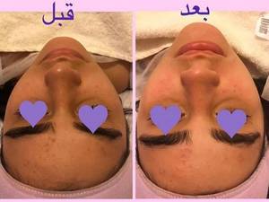 پاکسازی پوست