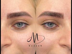 کاشت ابروی هایپر نچرال