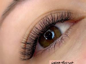 کاشت مژه 
