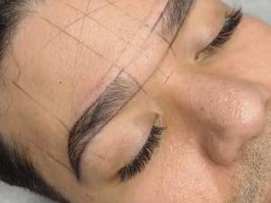 میکروبلیدینگ‌آقایان