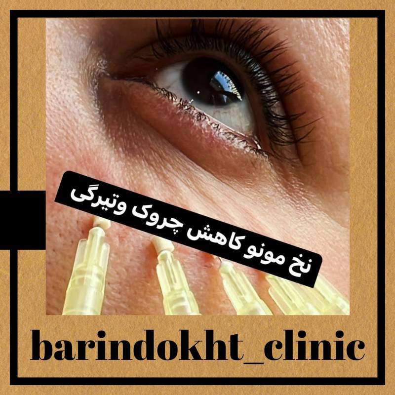 لیفت صورت بانخ