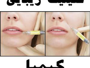 بایو فیلر صورت