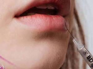 مراقبت های بعد از تزریق ژل