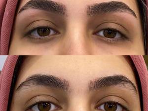 نحوه برداشتن ابروی دخترانه
