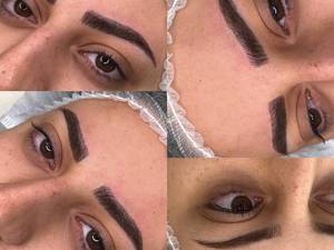 فیبروز ابرو 