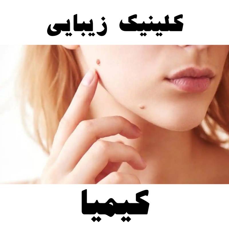 برداشتن خال و زگیل