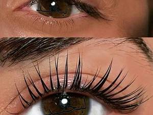 کاشت مژه