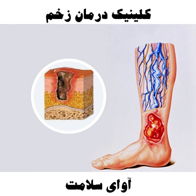 پانسمان زخم در منزل