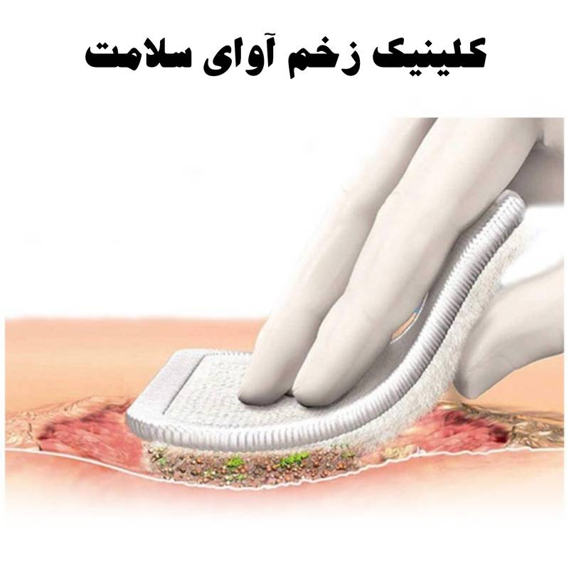درمان زخم بستر