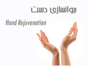 جوانسازی دست