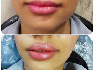 قیمت ژل لب روسی بوشهر
