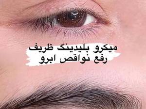 عکس میکرو ابرو بعد از یک هفته