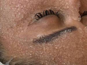 کاشت موقت مژه فیشر