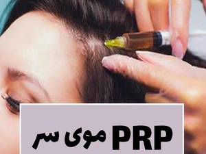 مزایای پی آر پی (PRP)