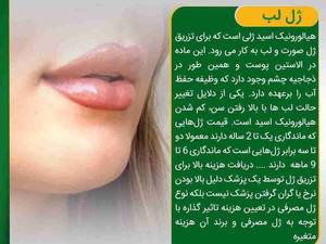 انجام ژل لب