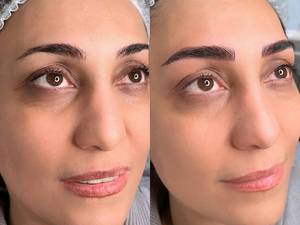 هزینه میکرو طبیعی ابرو چقدر است
