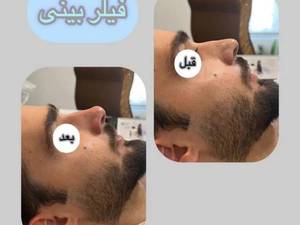 مرکز فیلر بینی در لاهیجان