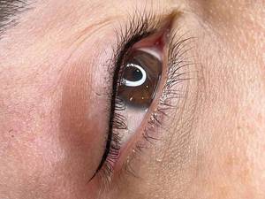 هزینه اجرای بن مژه در اراک