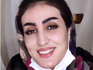 قیمت لیفت ابرو و اکستنشن مژه در تهران