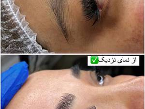 قیمت میکروبیلدینگ ابرو در پاکدشت