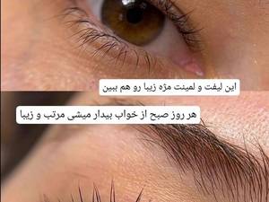 لیفت و احیای مژه در پاکدشت