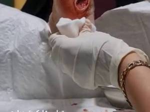 درمان زخم شارکو در ارومیه