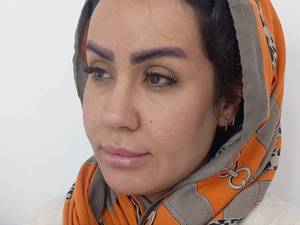 کاشت ابرو و بلفارو در تهران