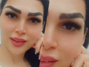 بهترین کاشت ابرو و بلفارو پلاستی در تهران