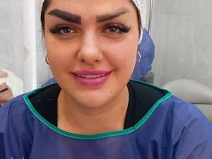 کاشت انواع مدل های ابرو ارزان در تهران