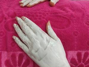 جوانسازی دست در اهواز