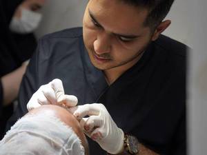 بهترین مرکز پی آر پی مو در غرب تهران
