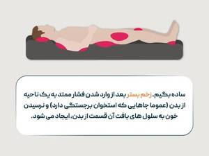 زخم فشاری چیست و درمان آن چیست؟