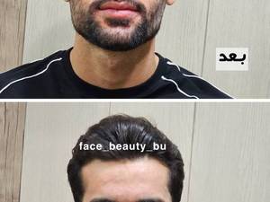 بهترین مرکز بوشهر برای زاویه فک
