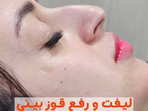 بهترین مطب زیبایی بوشهر