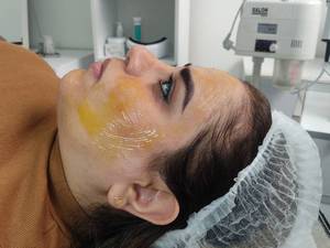 هزینه پلاژن تراپی تخصصی در اهواز