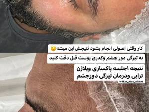 مرکز رفع سیاهی چشم در اهواز