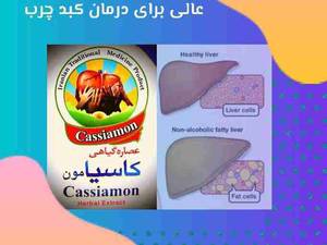 عصاره ریشه و برگ کاسنی