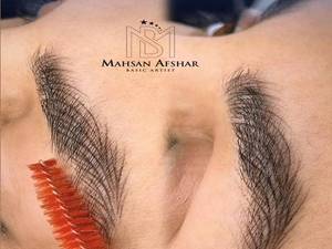 فیبروز ابرو طبیعی در قزوین