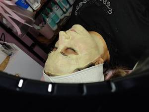 قیمت بوتاکس صورت در اهواز