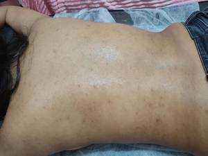 قیمت فیشیال کمر در اهواز