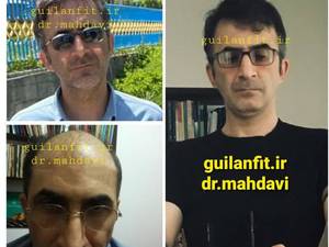 کاشت مو با تراکم بالا در رشت