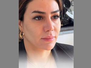 بهترین مرکز کانتورینگ صورت در لاهیجان