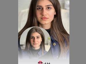قیمت هر سی سی ژل لب در لاهیجان