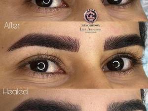 کلینک نانو بروز ابرو در عسلویه