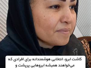 چگونگی کاشت تخصصی ابرو در تهران